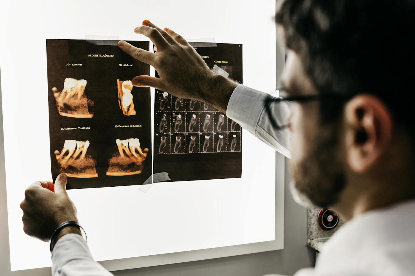 Dental X-rays reviewed on a light box